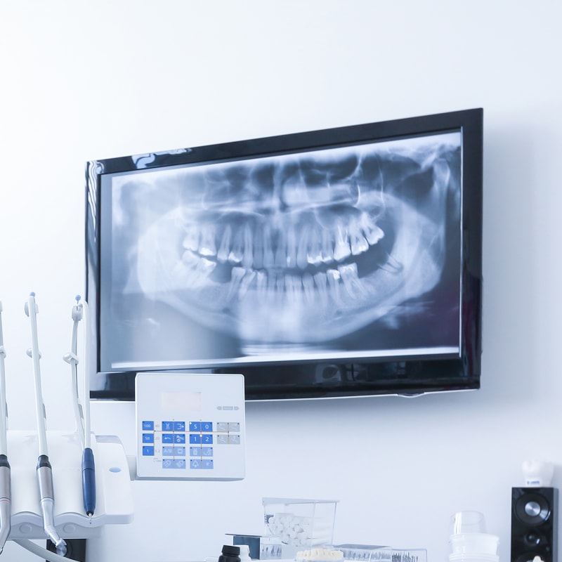 Dental Technology, Kanata Dentist